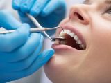 Precision Dentistry: Crafting Healthy and Beautiful Teeth